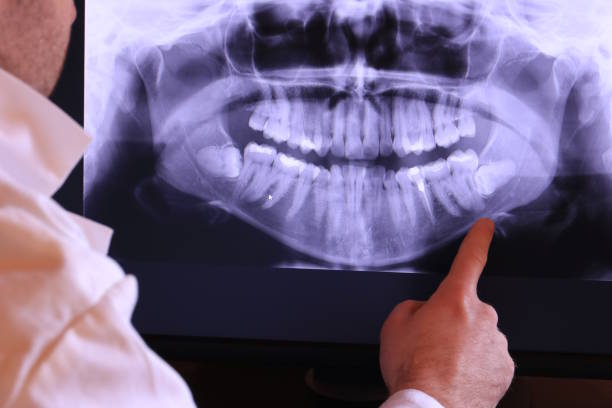 Best Weekend Emergency Dental Services in Shepherdstown, WV