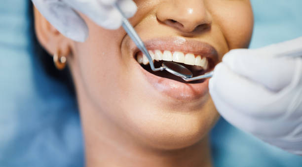 Best Emergency Denture Repair in Shepherdstown, WV