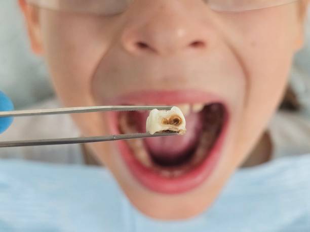 Best Emergency Pediatric Dental Care in Shepherdstown, WV