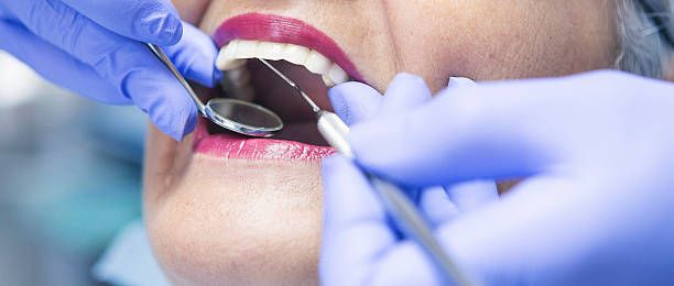 Best Emergency Wisdom Tooth Extraction in Shepherdstown, WV